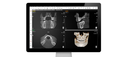 Software en accessoires